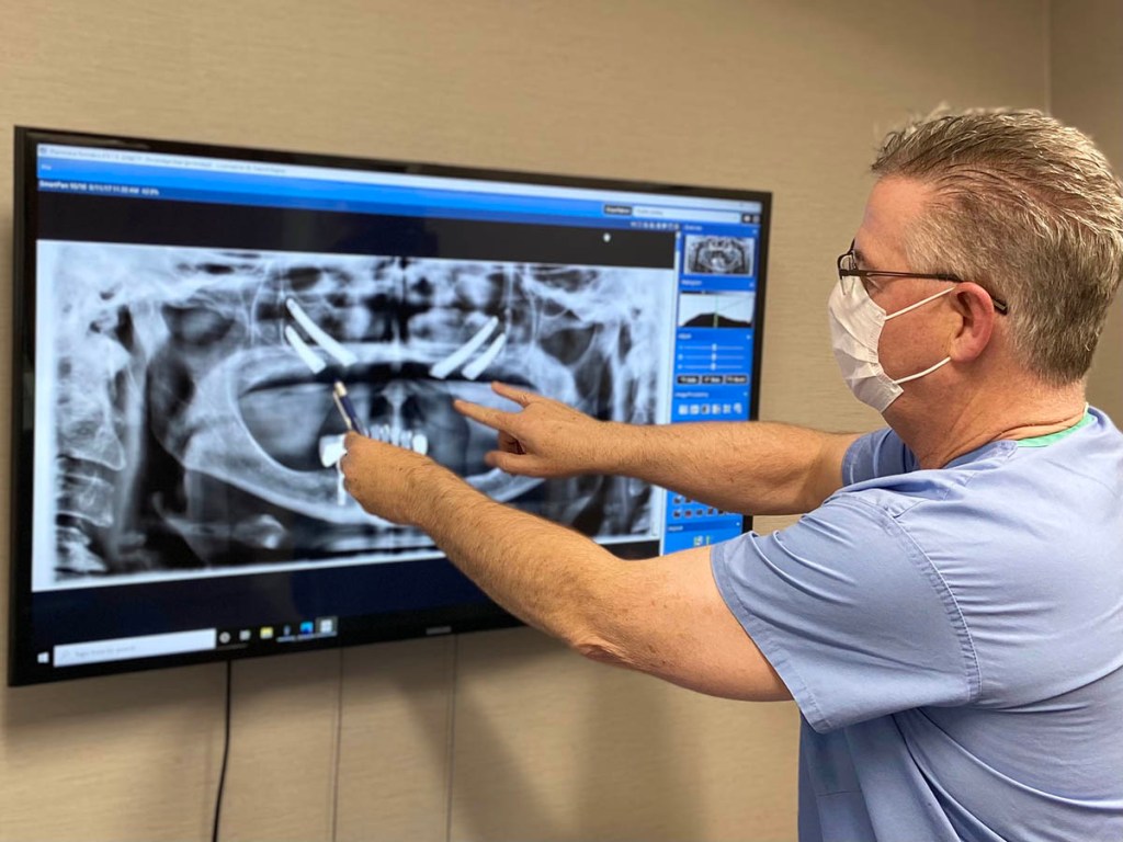 Dr Begley showing Zygomatic Implants